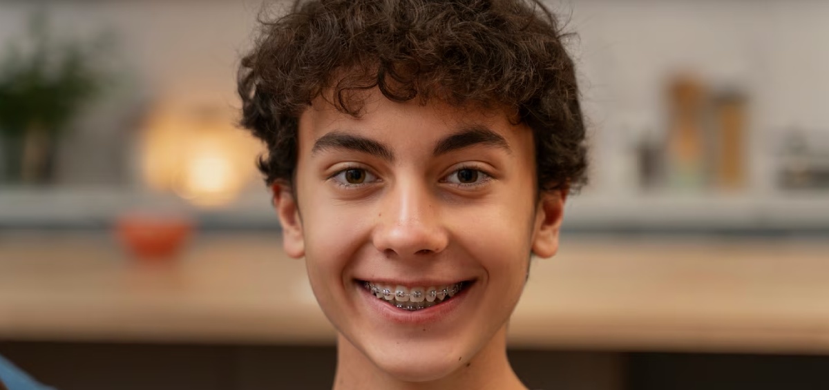 Top 5 reasons why Teenagers should opt Invisalign TEEN over Fixed Braces.