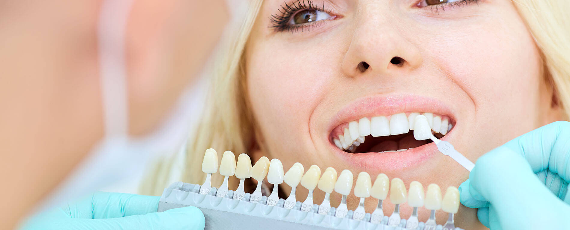 Teeth Whitening Treatment