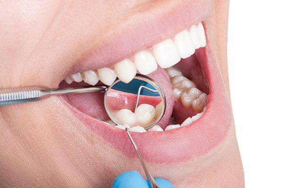 Gum-Disease Treatment