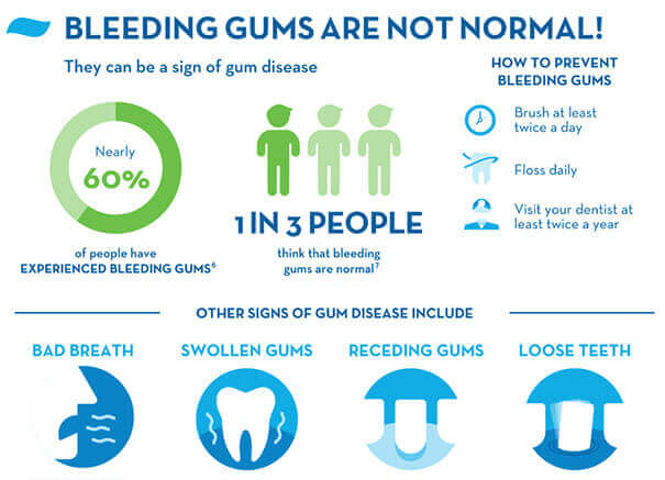 Bleeding Gums